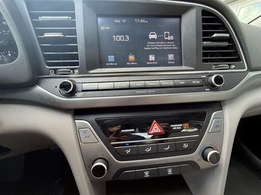 2017 Hyundai ELANTRA SE